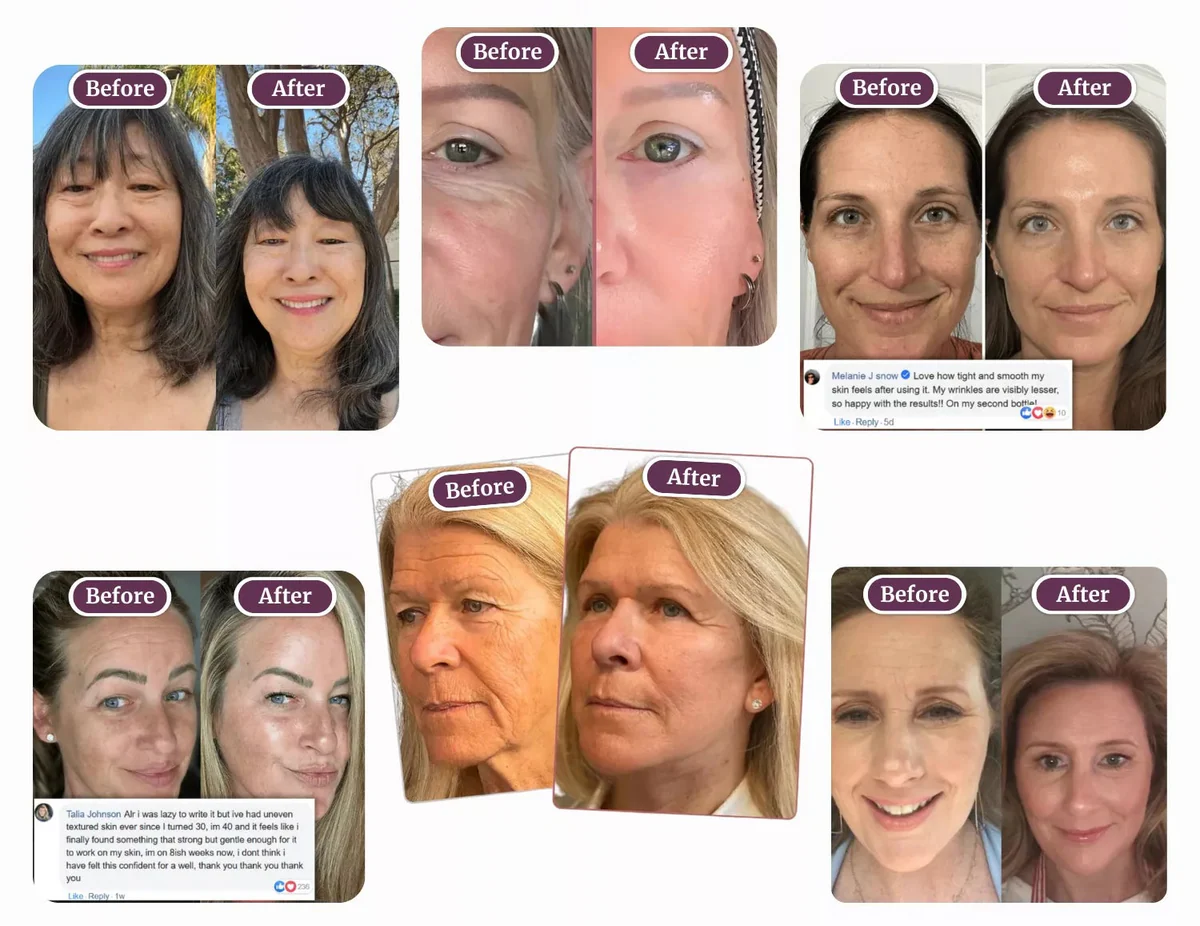 Verified Lumilux customer results — before and after smoker's lines and lip area